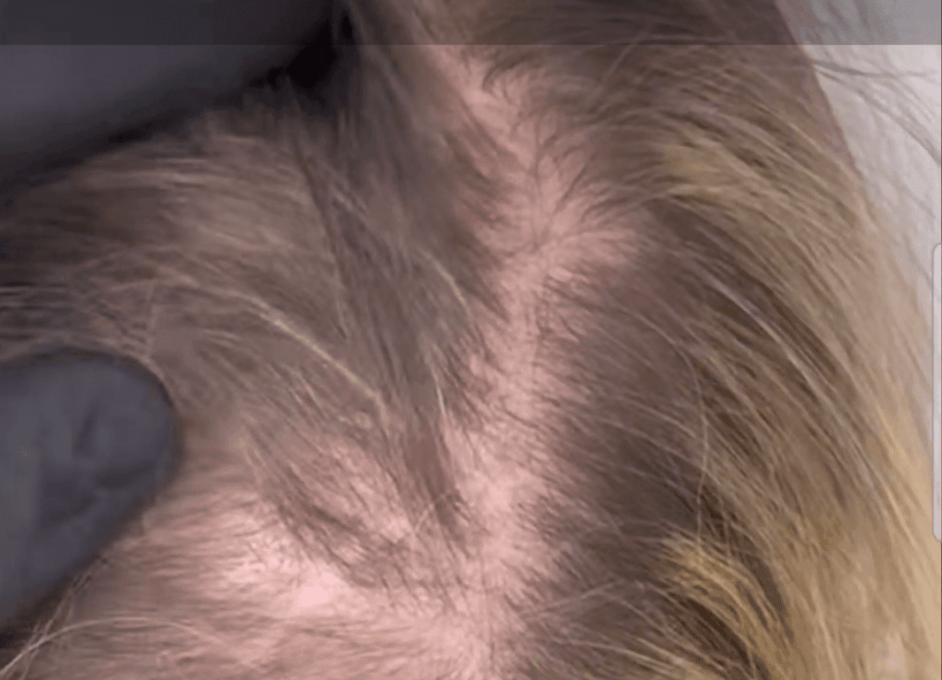 Female SMP Treatments