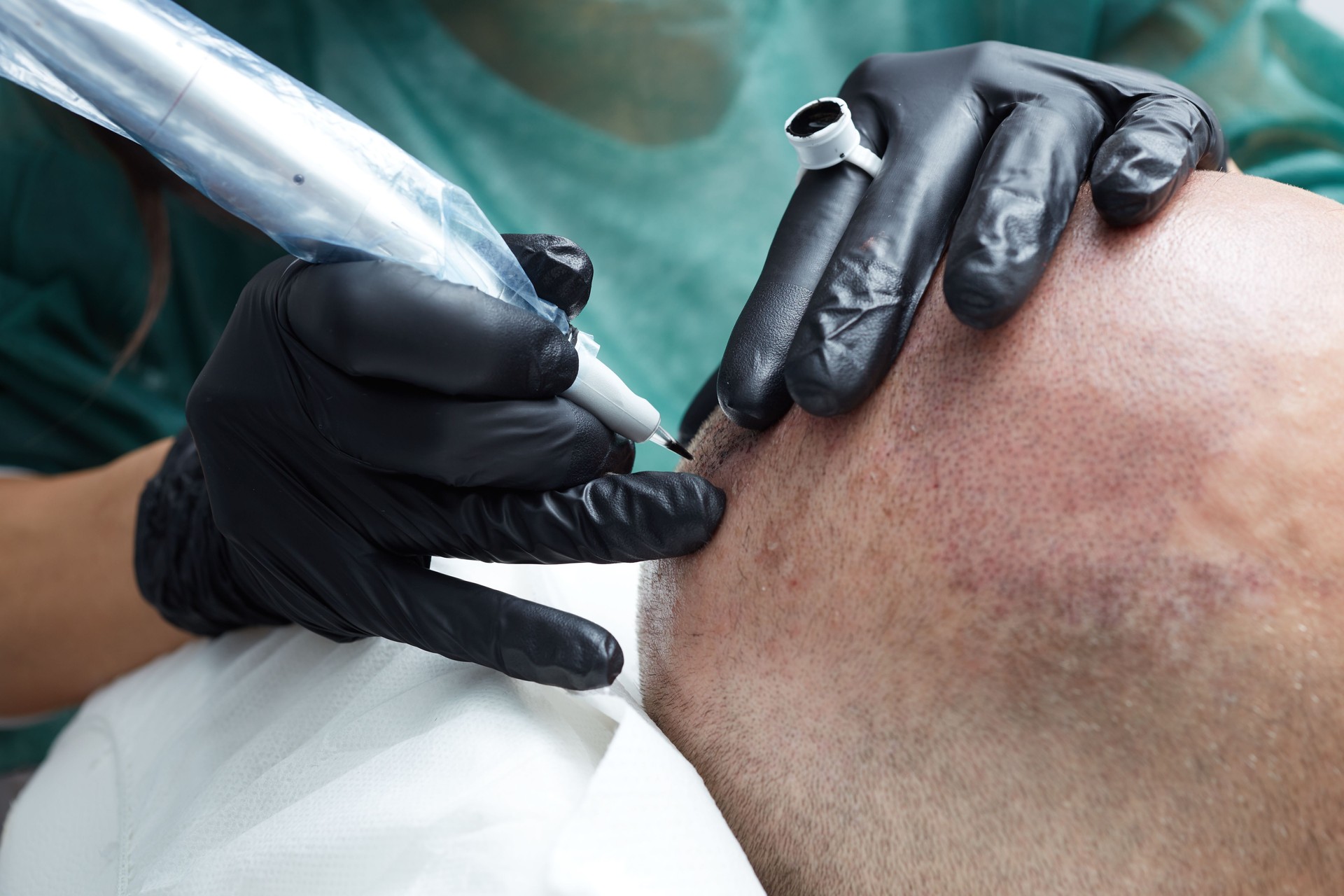 Cosmetologist making permanent makeup on man head - tricopigmentation