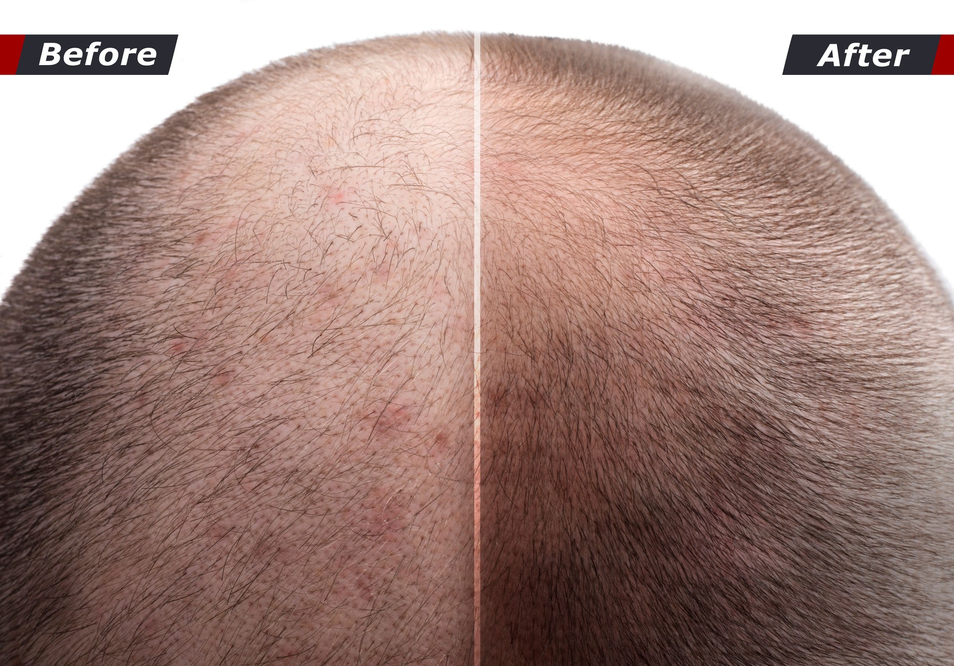 Men hair after using cosmetic powder, cream, spray to thicken hair