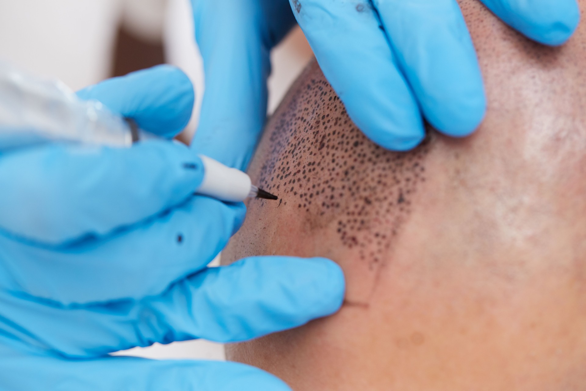 professional tattooist making permanent make up tricopigmentation