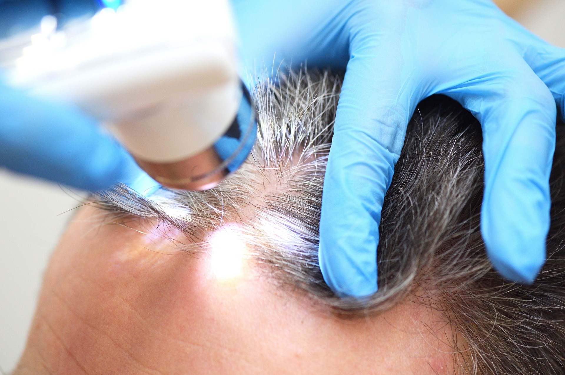 A cosmetologist-trichologist diagnoses the condition of a male patient's hair with gray hair using a trichoscope.